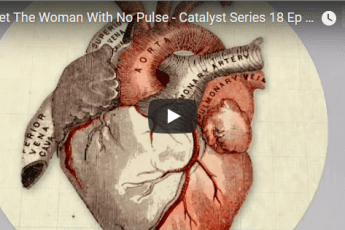 Meet The Woman With No Pulse